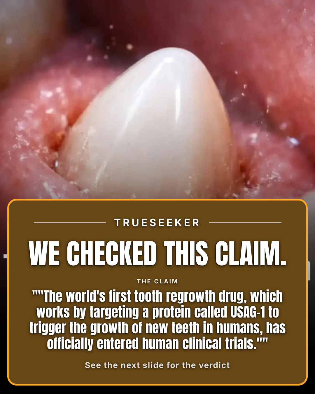 Fact-check card, verdict Partially accurate but misleading